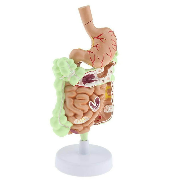 Étude Anatomique du Modèle de Pathologie Gastro-Intestinale Humaine