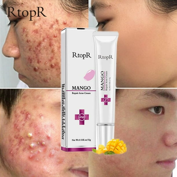 Bioaqua-crema facial hidratante para la salud, ácido hialurónico, blanqueador de acné, Cosméticos coreanos, productos para el cuidado de la piel"one" Fivean LED