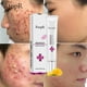 thumbnail image 1 of Bioaqua-crema facial hidratante para la salud, ácido hialurónico, blanqueador de acné, Cosméticos coreanos, productos para el cuidado de la piel"one" Fivean LED, 1 of 2