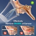 thumbnail image 3 of Morfone Ear Wax Removal with One-Piece Waste Tank, Ear Cleaner with Water Temperature Sensor, 4 Pressure Settings, Ear Cleaning Kit for Ear Wax Buildup & USB-C Cable, IPX6, Gray, 3 of 8