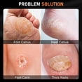 thumbnail image 2 of Juego de cuchillos de pedicura DRMODE Professional, 4 piezas, acero inoxidable, 2 of 7