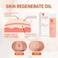 thumbnail image 3 of Aceite Regenerador De La Piel, 3 of 7