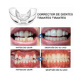 thumbnail image 2 of Retenedor De Dientes Para Corrección De Sonrisa, 2 of 4