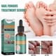 thumbnail image 2 of Extra Strength Nail Repair Fluid Toenail And Nail Solution Toenails And Nails Repair Damaged And Discolored Nails 30ml G, 2 of 5