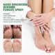 thumbnail image 5 of Hand And Foot Spray, Athlete's Foot Deodorant, Anti-itching, Chapped Skin Repair Hand And Foot Spray Lotion & Moi, 5 of 5
