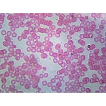 Human Blood; Smear; H&E Stain by Go Science Crazy