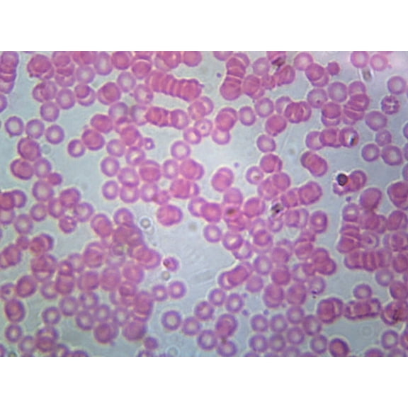 Human Blood; Smear; H&E Stain by Go Science Crazy