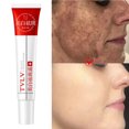 thumbnail image 3 of Crema blanqueadora para pecas, melasma, manchas oscuras, producto para eliminar la pigmentación, desvanece las manchas, melanina, reparación rápida, ilumina el cutis, cuidado coreano, 3 of 5