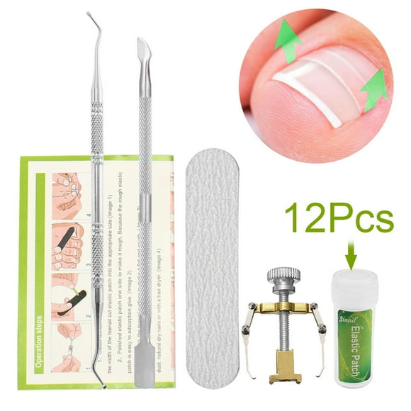 Ingrown Clou d'Orteil Set Ongle Traitement Ongle Redressage Patch Lifter Fixer Récupérer Outil Kit de soins des pieds