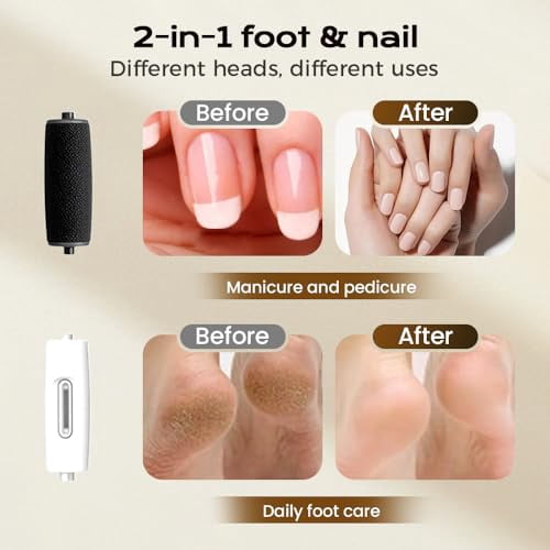 Electric Callus Removers for Feet, 2026 Upgraded Rechargeable Portable Electric Foot Callus Remover Pedicure Kits, Removes Dry Skin for Smoother Feet, for Feet & Hands, Assorted