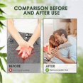 thumbnail image 4 of 1/2pcs Pubic Lice Scabies Removal Cream Herbal Anti Lice Eggs Anti-itch, 4 of 5