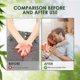 thumbnail image 4 of 1/2pcs Pubic Lice Scabies Removal Cream Herbal Anti Lice Eggs Anti-itch, 4 of 5