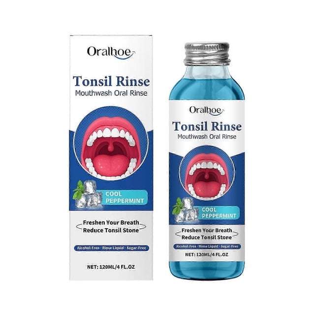 Removedor de cálculos amigdalinos, enjuague bucal natural para cálculos amigdalinos, enjuague bucal líquido para aliviar las amígdalas, tratamiento del mal aliento y alivio de la sequedad bucal.