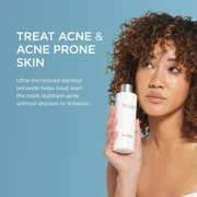 Jan Marini Skin Research Benzoyl Peroxide 2.5% Acne Treatment Wash - 8 Fl Oz