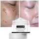 thumbnail image 1 of Crema Facial blanqueadora con vitamina C 20%, Gel reparador para eliminar manchas oscuras, pecas y melanina, ilumina la piel, 2 unidades Fivean unisex, 1 of 1