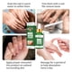 thumbnail image 3 of Esencia de reparación de uñas 30ml Aceite de nutrición para uñas Tratamiento de uñas Aceite de esencia Tratamiento de uñas natural para uñas y Colco Aceite de esencia de uñas, 3 of 8