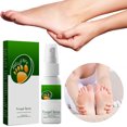 thumbnail image 5 of Bradem Foot Masks , Deodorant, Herbal Foot Spray Foot Spray Removal Odor Peeling Foot Care Spray Foot Odor Eliminator for Shoes Sports Equipment and Feet 30ml, 5 of 7