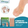 thumbnail image 4 of Vadktai 48 Pieces U Shaped Felt Callus Pads Metatarsal Pads Forefoot Foot Pads Pain Relief Foot Cushion Keep Protecting Calluses from Rubbing on Shoes Adhesive Pads for Men and Women, 4 of 9
