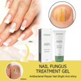 thumbnail image 2 of Gel y crema para tratamiento de uñas Nutraboost 20ml KUNLEN, 2 of 7