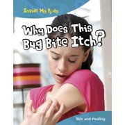 Why Does This Bug Bite Itch?: Skin and Healing