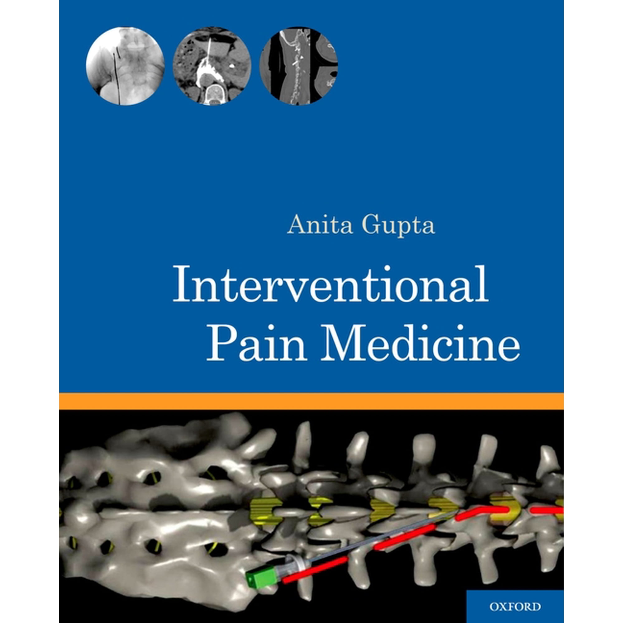 Interventional Pain Medicine, (Spiral-Bound)