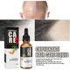 thumbnail image 4 of Aceite para el crecimiento del cabello, esencia eficaz para el cuidado del cabello, crecimiento saludable del cabello, más fuerte y más grueso, 4 of 5