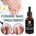 thumbnail image 2 of 30ml/50ml Powerful Nails Care Repair Nail Anti-Fungus Onychomycosis Removal, 2 of 4