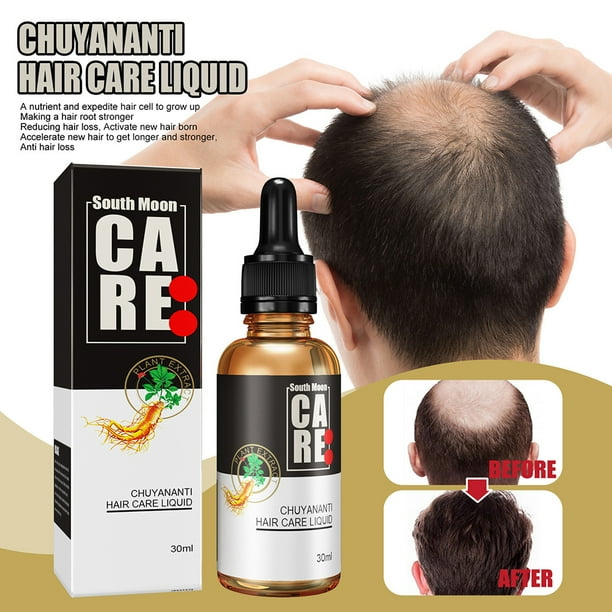 Hair Grow Fiber Repair Treatment Growth Spray Ginger Extract Spray Products Effective Hair Anti Roots Nourish Treatments Hair | Hair Grow Fiber Repair Treatment Growth Spray Ginger Extract Spray Products Effective Hair Hair Grow Fiber Repair Treatment Growth Spray Ginger Extract Spray Products Effective Hair Anti Roots Nourish Treatments Hair | Hair Grow Fiber Repair Treatment Growth Spray Ginger Extract Spray Products Effective Hair