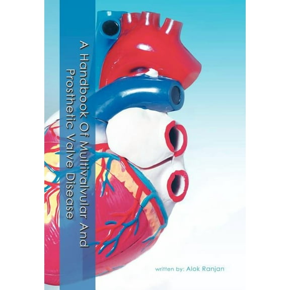 A Handbook Of Multivalvular and Prosthetic Valve Disease, (Hardcover)