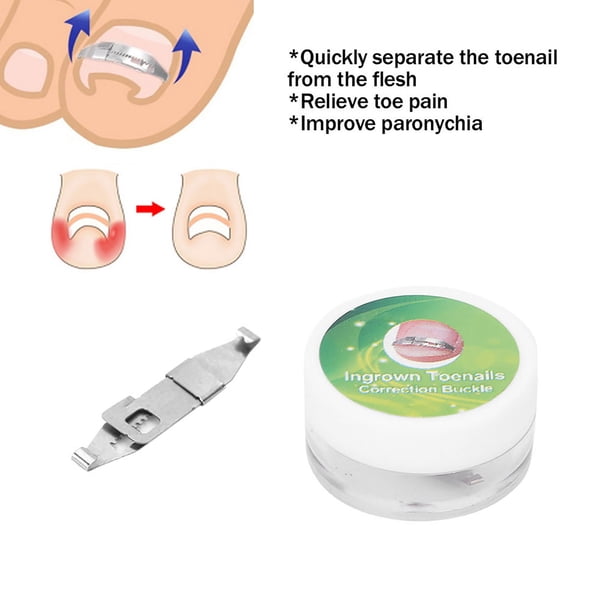 Tratamiento de uñas encarnadas ANGGREK Tratamiento de uñas encarnadas Corrector de uñas encarnadas de acero inoxidable Alivio del dolor Tratamiento de paroniquia Herramienta de ANGGREK Otros