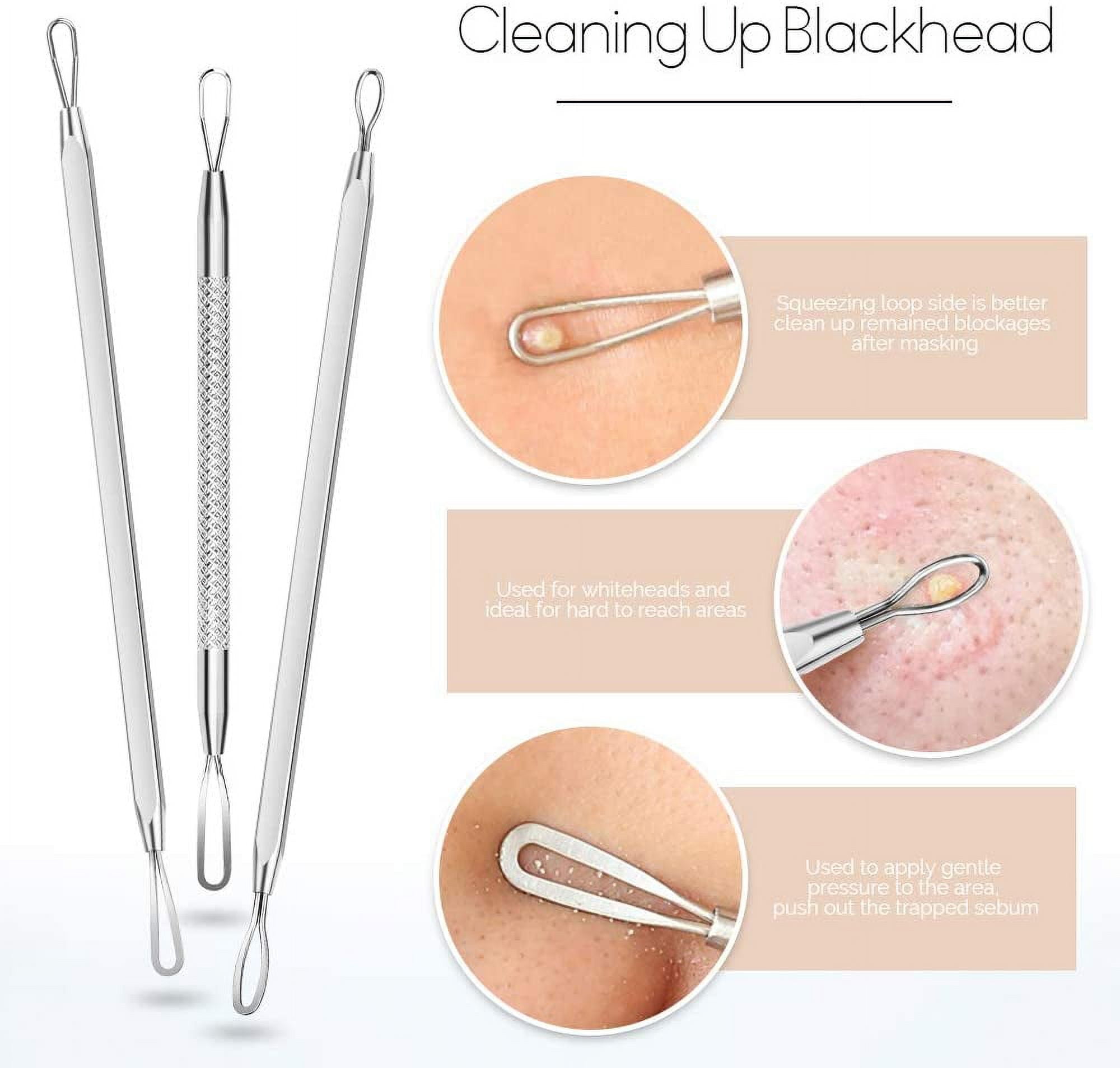 7PCS Blackhead Remover, Pimple Tool Kit, Acne Extractor Tools, Blemish  Whitehead Removal, Professional Curved Tweezers Kits, Premium Stainless  Steel 