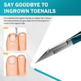 thumbnail image 2 of BEZOX Ingrown Toenail Clippers for Seniors Thick Toenails - Straight Toe Nail Clippers for Ingrown Nails, Precision Grooming Toenail Scissors for Healthy Nails - Blue, 2 of 8