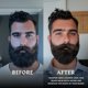 thumbnail image 4 of B&#2013265921lsamo para barba Striking Viking - 30 g, paquete de 4 - Acondicionador totalmente natural con aceite de karit&#2013265929 y jojoba - Suavizante para el picor, 4 of 9