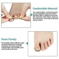 thumbnail image 5 of 100 piezas de pegatinas correctoras de uñas, parche corrector de uñas encarnadas, resistente al agua, tratamiento de paroniquia, herramienta de pedicura correctora de recuperación, 5 of 5