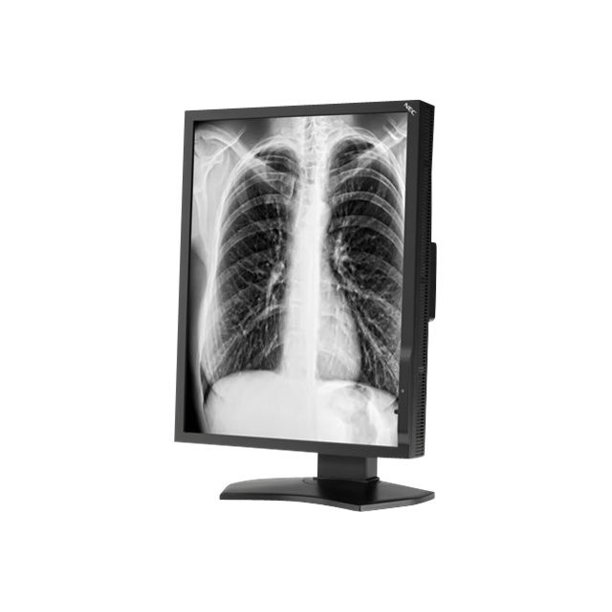 Nec Md211g3 Lcd Monitor 3mp Grayscale 21 3 21 3 Viewable 48 X 1536 1450 Cd M 900 1 13 Ms Dvi D Displayport Walmart Com Walmart Com