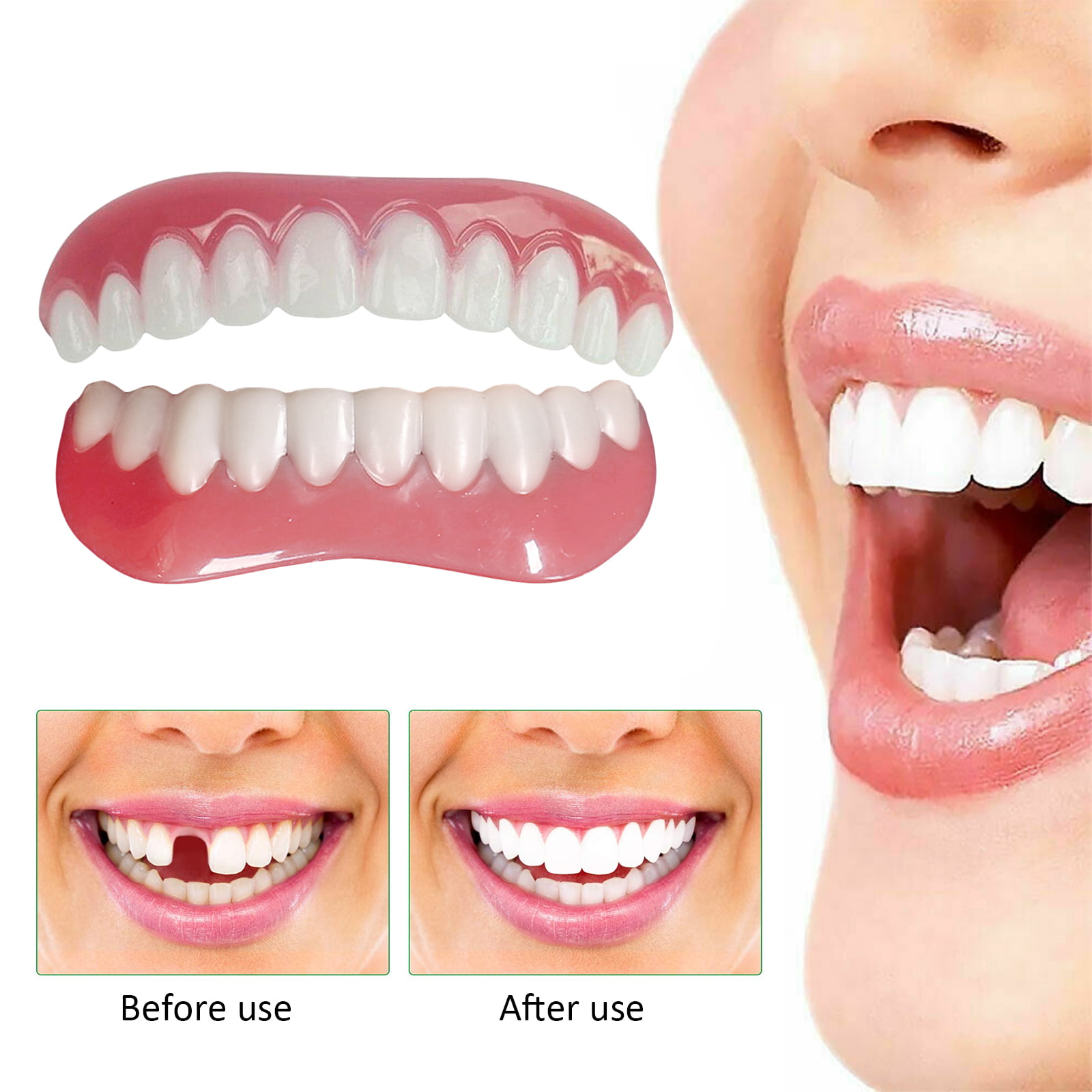 Suburbio Resignación Náutico Instant Smile Teeth Upper Veneer Personal Fit Reusable- Small | Reusable  Denture Covers,, Cosmetic Dental Veneers, Teeth Dentures | vladatk.gov.ba