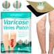thumbnail image 2 of Parche de venas varicosas para aliviar la Vasculitis de las piernas, parches de venas varicosas, mejora la sangre del pie, cuidado de la salud, 2 of 4