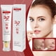 thumbnail image 1 of And Wrinkle Cream Wrinkle Cream Wrinkle Face Cream Face Cream Wrinkle Face Cream For Men Wrinkle Collag, 1 of 9