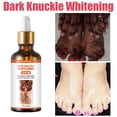 thumbnail image 3 of Suero blanqueador rápido para nudillos oscuros, Corrector de melanina para nudillos de manos, producto eliminador de manchas intensas para el cuidado de la piel negra, 50ml, 3 of 5