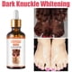 thumbnail image 3 of Suero blanqueador rápido para nudillos oscuros, Corrector de melanina para nudillos de manos, producto eliminador de manchas intensas para el cuidado de la piel negra, 50ml, 3 of 5
