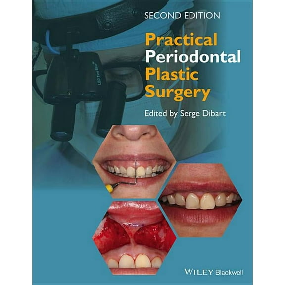Practical Periodontal Plastic Surgery (Hardcover)