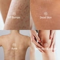 thumbnail image 4 of Exfoliante corporal POP MODERN.C Kp Bump Eraser 300 ml con ácido salicílico, 4 of 9
