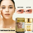 gold-revitalizing-eye-firming-lifting-dark-circle-fine-line