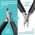 thumbnail image 5 of RONAVO Heavy Duty Toenail Clippers for Ingrown Toenails, Slanted Curved Blade Professional Toe Nail Clippers for Fine Trimming, Nail Clipper with Anti-Slip Long Handle for Men Seniors, 5 of 7