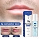 thumbnail image 5 of 1-3X Lip Serum for Men, Moisturizing Long Lasting for Lip Care and Dry 10ml, 5 of 5