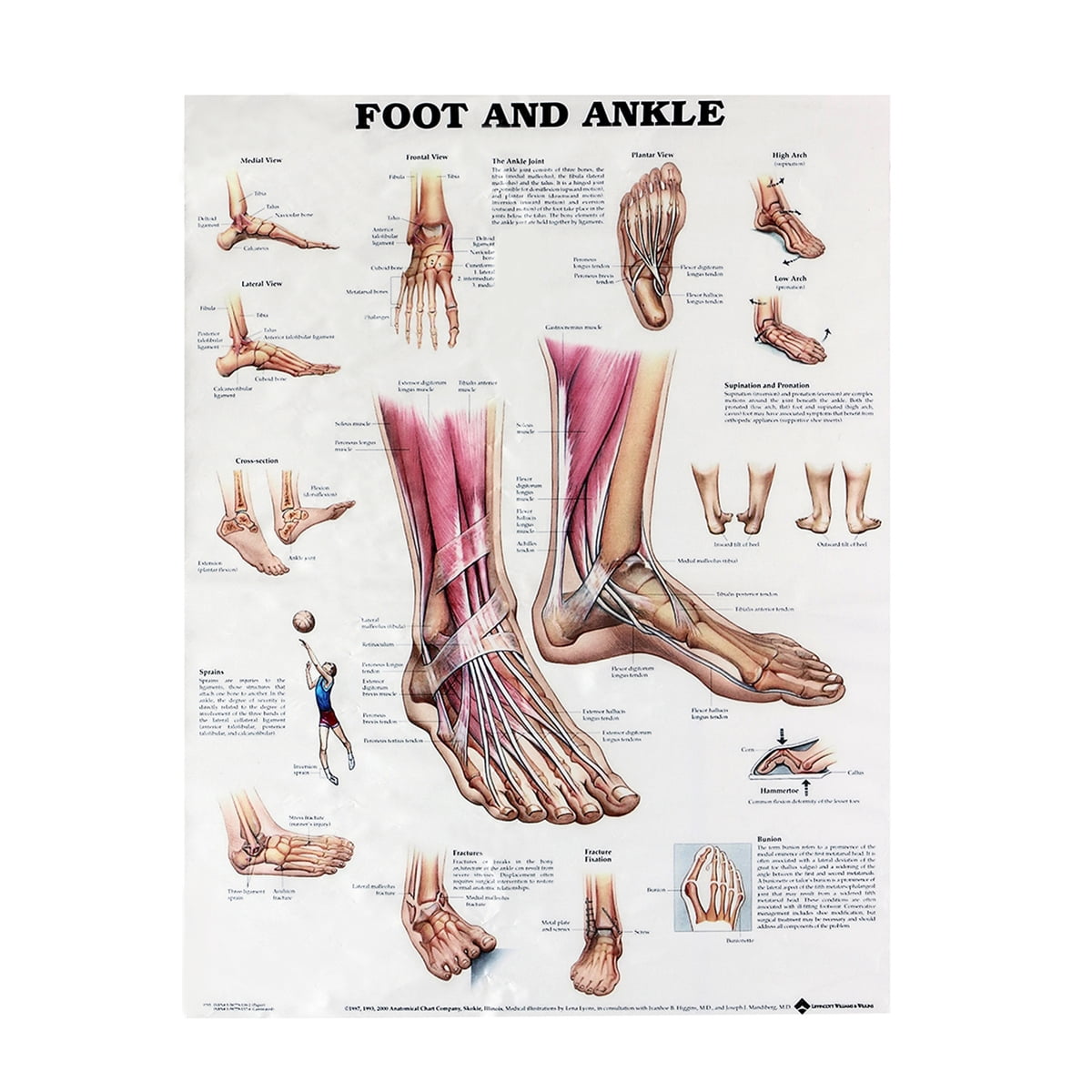 Poster Anatomie Blessures Pied Cheville Plastifié 45x68 Cm Affiche Anatomique Pied Et Cheville - 45,7x68,6 Cm - Plastifiée Double Face - Médecine, Kiné, études Poster Médical Plastifié