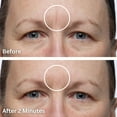 thumbnail image 6 of Dermaflage Scar Filler, Acne Scar Filler, Scar Concealer Makeup, 1 Mo Supply - Light, 6 of 10