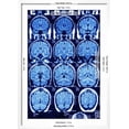 thumbnail image 3 of Brain Scans, MRI Scans, Figurative Framed Art Print Wall Art by PASIEKA Sold by Art.Com, 3 of 6