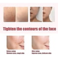 thumbnail image 5 of Limpiador facial, dispositivo de belleza, limpieza ultrasónica de poros, rosa, 5 of 5