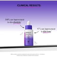thumbnail image 3 of (Pack Of 3) Derma E Serum Ultra Lift Concentrated 1 Oz, 3 of 6